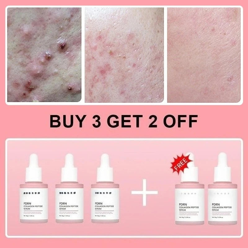 ✨ Korean Salmon PDRN Collagen Peptide Serum ⭐