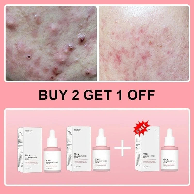 ✨ Korean Salmon PDRN Collagen Peptide Serum ⭐