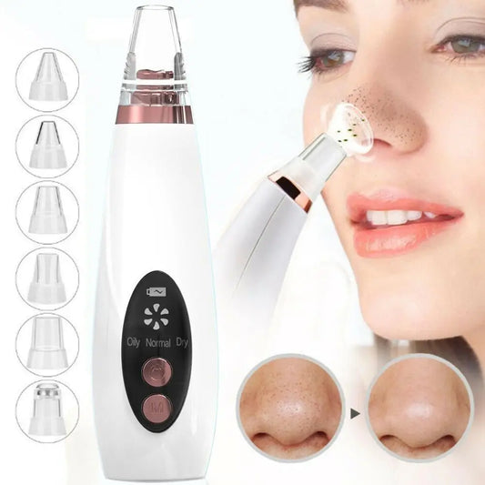 💖 Electric Blackhead Remover with 3-Level Suction