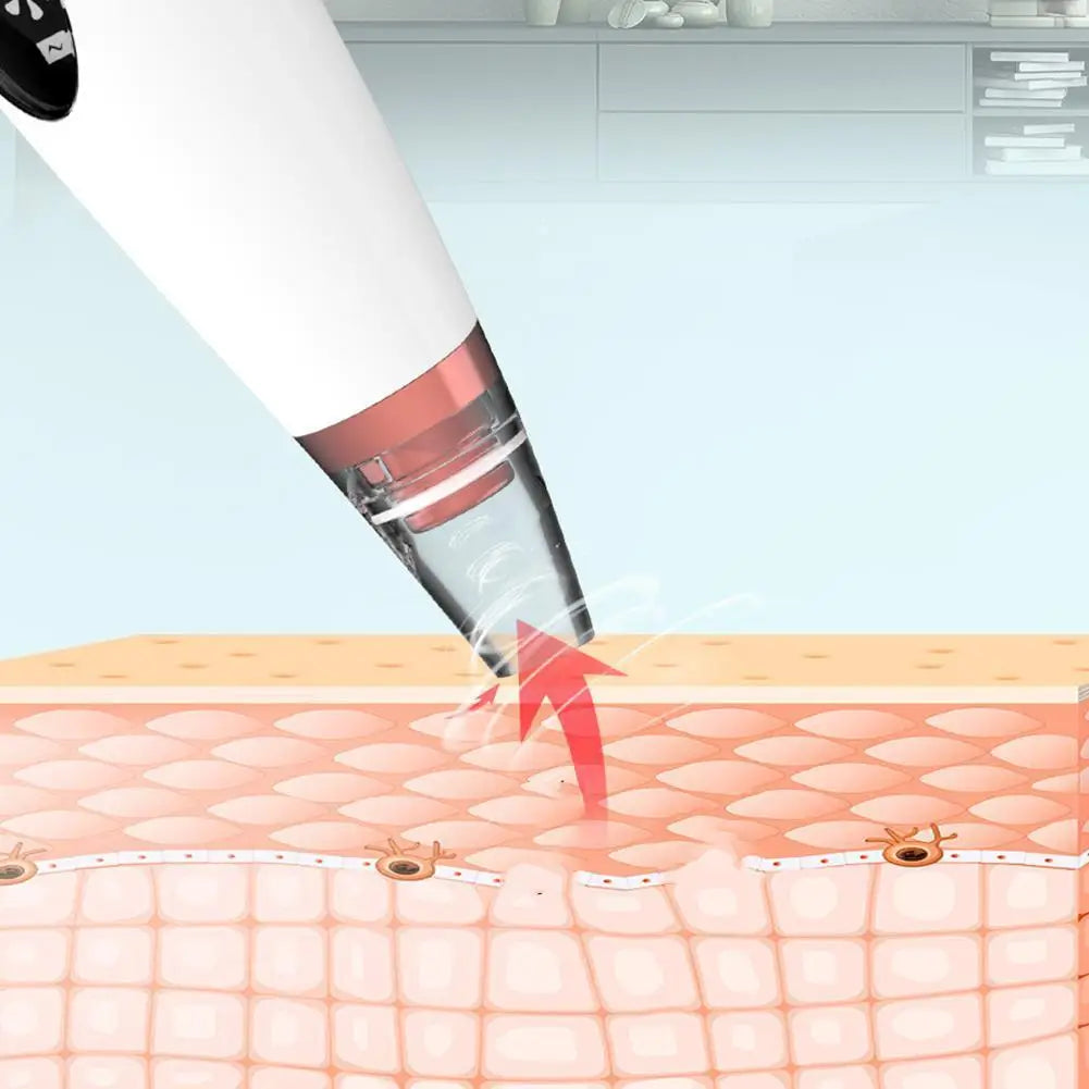 💖 Electric Blackhead Remover with 3-Level Suction