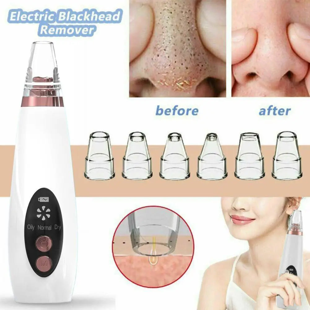 💖 Electric Blackhead Remover with 3-Level Suction