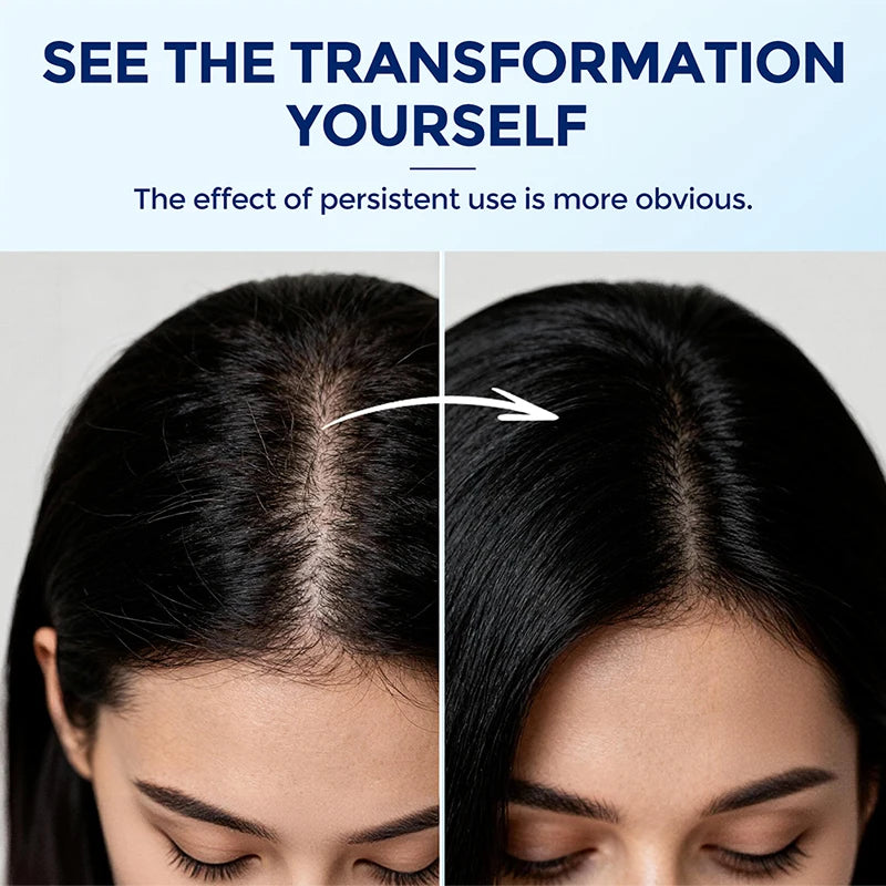 💖 Ginger Hair Growth Oil for Stronger & Healthier Hair